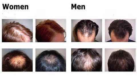 Organic Hair Growth Essence - Home Fusion